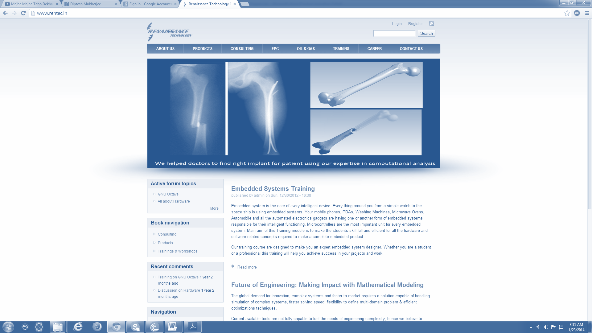 Orthopedic bone implant study engineering image from Tectorq presentation